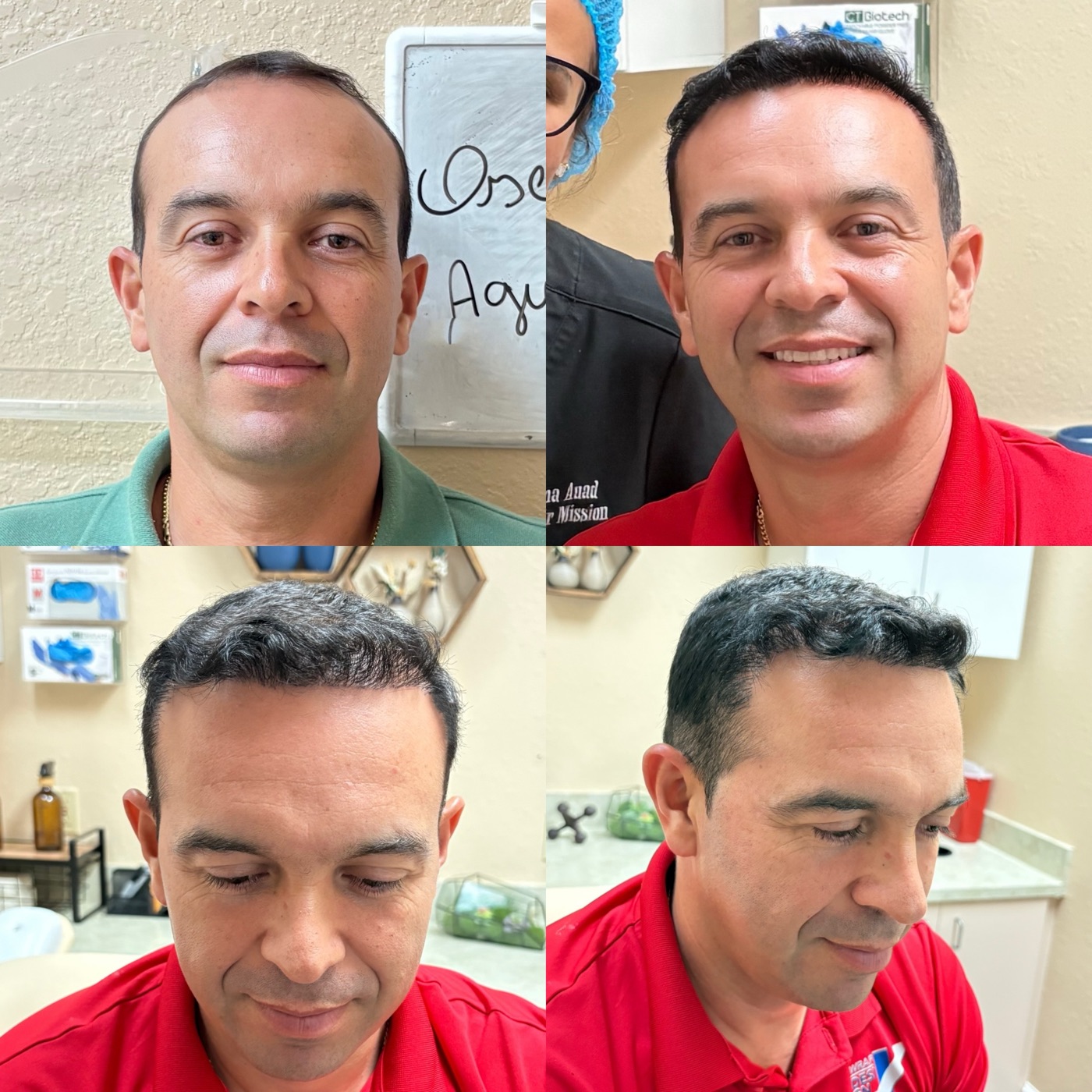 Hair restoration case